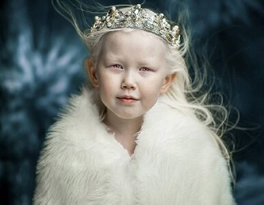 Miniatura: Zdjęcia 8-letniej albinoski nazywanej...